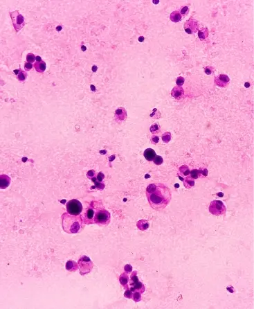 Laboratorio de Análisis en Barcelona, Madrid y Málaga - Análisis Clínicos|Inicio