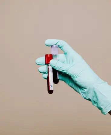 Laboratorio de Análisis en Barcelona, Madrid y Málaga - Análisis Clínicos|Inicio